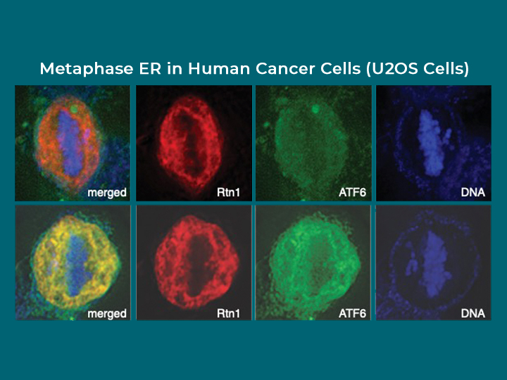 Metaphase ER in human cancer cells